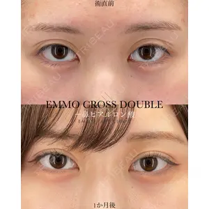 EMMO FACE CLINIC 大宮院 廣松 直樹医師の症例