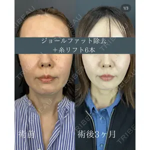 ルラ美容クリニック 名古屋本院 鶴田 佳雅医師の症例