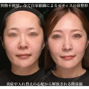 Zetith Beauty Clinic 銀座院 鉄 鑠医師の症例