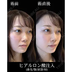HAAB×DREAM BEAUTY CLINIC 東京本院 佐野 圭医師の症例