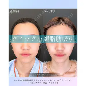 ルラ美容クリニック 札幌本院 佐藤 雄紀医師の症例