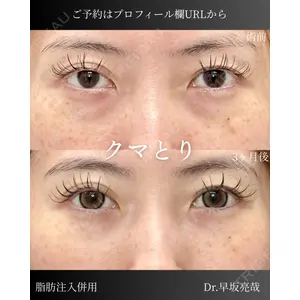 ルラ美容クリニック 札幌本院 早坂 亮哉医師の症例