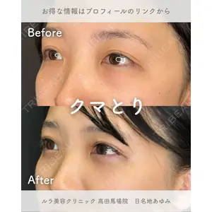 ルラ美容クリニック 高田馬場院 日名地 あゆみ医師の症例