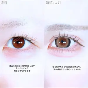アリエル美容クリニック 水戸院 天白 典秀医師の症例
