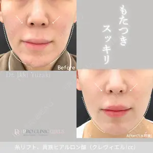 PRO CLINIC プロクリニック 銀座院 柚﨑 一輝医師の症例