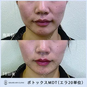 グランジョイクリニック 道上 育子医師の症例