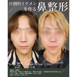 Tokyo Tensei Clinic 大阪梅田院 岩本優輝医師の症例