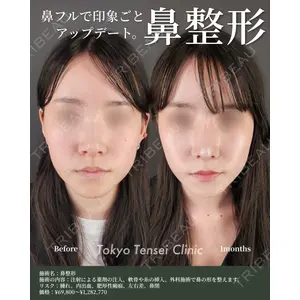 Tokyo Tensei Clinic 大阪梅田院 岩本優輝医師の症例
