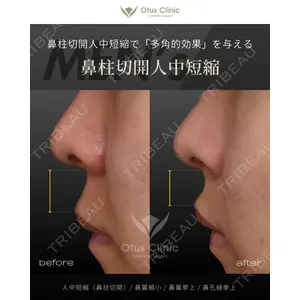 Otus Clinic 【オータスクリニック】 中 徳太郎医師の症例