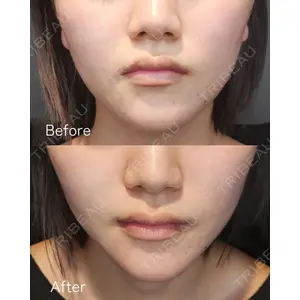 Tokyo Tensei Clinic 新宿院の症例