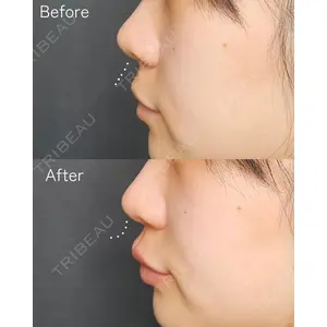 Tokyo Tensei Clinic 新宿院の症例