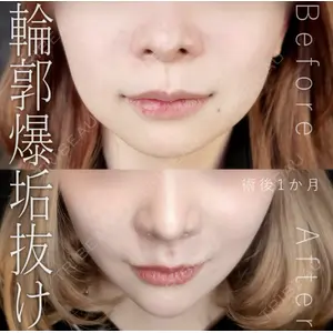 Tokyo Tensei Clinic 新宿院 辻 大成医師の症例