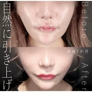Tokyo Tensei Clinic 新宿院 辻 大成医師の症例