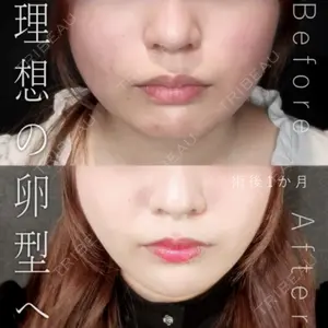Tokyo Tensei Clinic 新宿院 辻 大成医師の症例