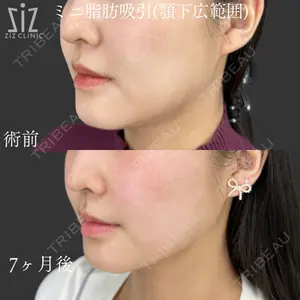 ziz CLINIC 村岡 史子医師の症例