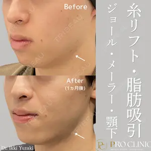PRO CLINIC プロクリニック 銀座院 柚﨑 一輝医師の症例
