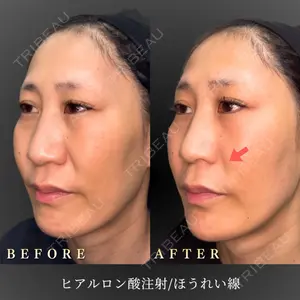 BiBiクリニック 山本 幸一郎医師の症例