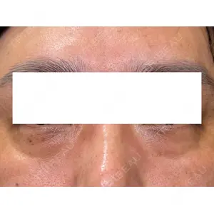Ledian Clinic六本木の症例