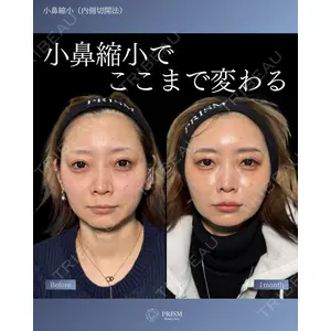 PRISM Beauty Clinic 町田院の症例