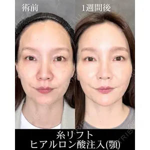 HAAB CLINIC 福岡院 北村 可恋医師の症例