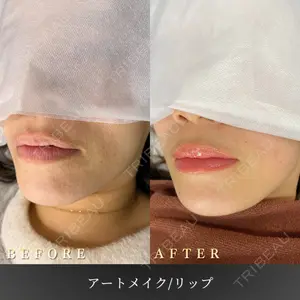 BiBiクリニックの症例