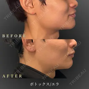 BiBiクリニック 山本 幸一郎医師の症例