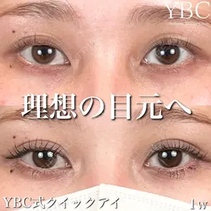 YBC横浜美容外科 池袋院 磯村 亮輔医師の症例