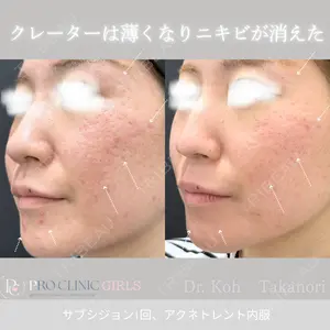 PRO CLINIC プロクリニック 銀座院 洪 嵩典医師の症例
