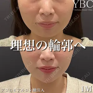 YBC横浜美容外科 池袋院 磯村 亮輔医師の症例