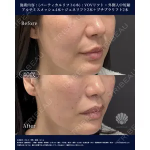 LA MER CLINIC 辻 航平医師の症例