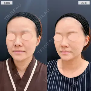 A CLINIC（エークリニック） 仙台院 伊藤 瑠桂医師の症例