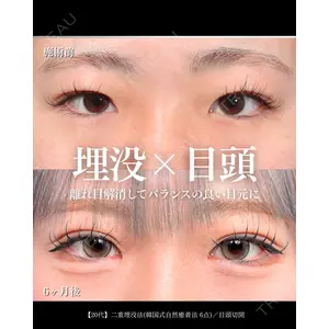 東京シンデレラ美容外科 大宮院 竹田 昌平医師の症例
