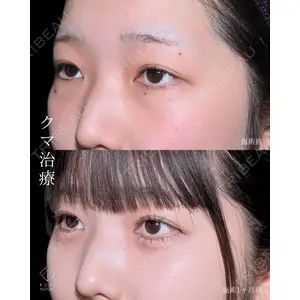 藤・ナチュレ美容クリニック 銀座院 小川 杏平医師の症例