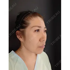 HAAB BEAUTY CLINIC 南青山本院（新院） 小平 佳典医師の症例
