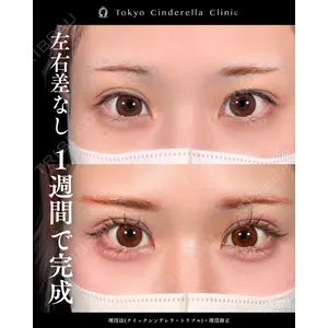 東京シンデレラ美容外科 新宿院 吉原 伯医師の症例