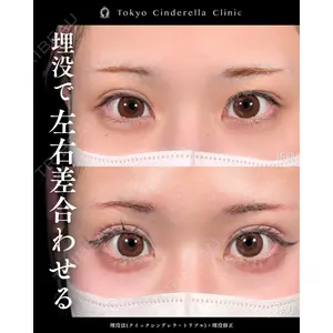 東京シンデレラ美容外科 新宿院 吉原 伯医師の症例