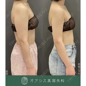 オアシス美容外科 遠藤 剛史医師の症例