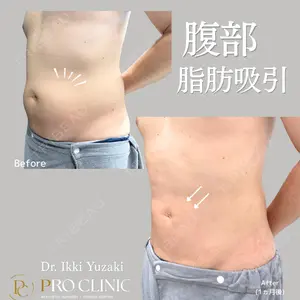 PRO CLINIC プロクリニック 銀座院 柚﨑 一輝医師の症例