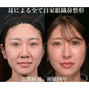 Zetith Beauty Clinic 銀座院 鉄 鑠医師の症例