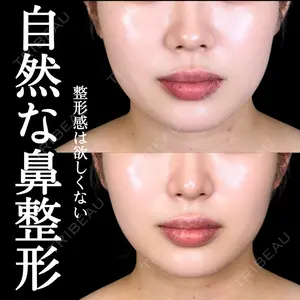 アリエル美容クリニック 大宮院 阪野 一世医師の症例