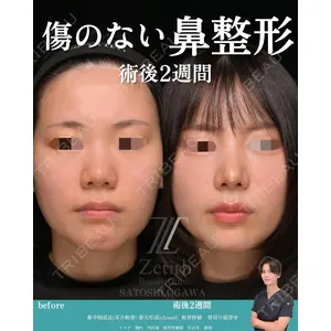 Zetith Beauty Clinic 銀座院 小川 悟史医師の症例