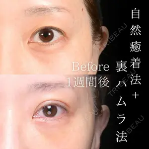 Zetith Beauty Clinic 大阪心斎橋院 楠本 拓哉医師の症例
