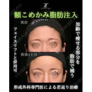 Zetith Beauty Clinic 新宿院 副島直人医師の症例