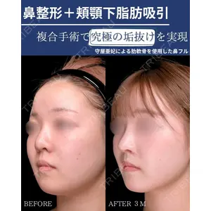 Zetith Beauty Clinic 銀座院 守屋 亜妃医師の症例