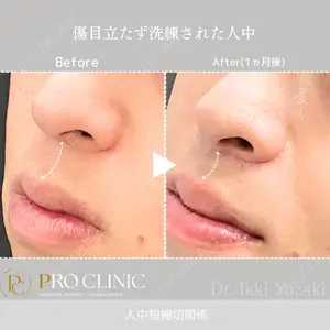 PRO CLINIC プロクリニック 銀座院 柚﨑 一輝医師の症例