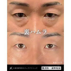 小倉美容外科ネビュラクリニック 浦野 正樹医師の症例