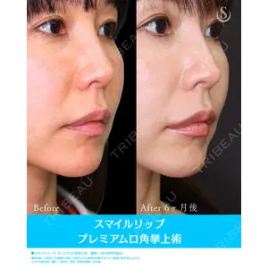 聖心美容クリニック 六本木院の症例