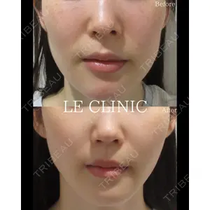 LE CLINICの症例