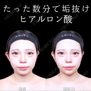 アリエル美容クリニック 水戸院 天白 典秀医師の症例