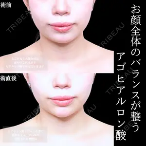 アリエル美容クリニック 水戸院 天白 典秀医師の症例